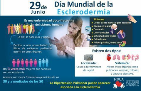 ¿Qué relación existe entre la Esclerodermia y la Hipertensión Pulmonar?