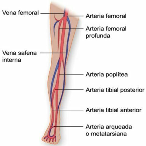 Europa aprueba un dispositivo que mejora la calidad de vida de pacientes con insuficiencia cardíaca por Hipertensión Arterial Pulmonar