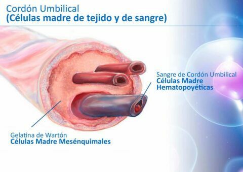 Se está probando en animales una terapia con células madre umbilicales que alivia los síntomas de la HAP