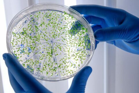 La detección precoz de Aspergillus podría ser clave para tratar pacientes graves con COVID-19