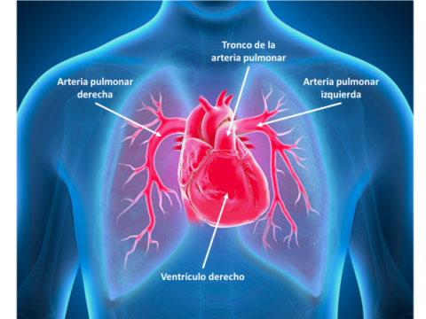 Estudio demuestra que la presión arterial pulmonar levemente alta significa un mayor riesgo de desarrollar HP