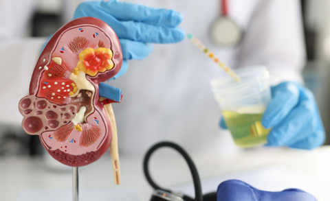 Mes de concientización del Cáncer de Riñon