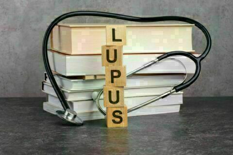 Lupus: ¿Qué es y cuáles son sus síntomas?