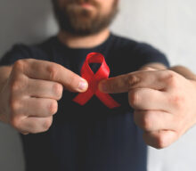 Día Mundial del Sida: En Argentina, 3 de cada 10 diagnósticos de VIH se realizan de manera tardía.